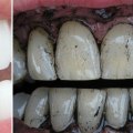 What biohacking means?